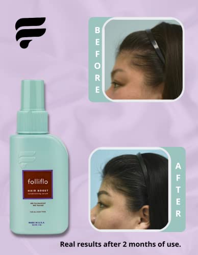 Folliflo Haj Boost El-A Kondicionáló Spray Szérum a Haj Növekedését, illetve a Haj Vedlés Kezelés