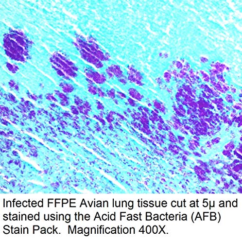 Sav Gyorsan Baktériumok (AFB) Folt Csomag, 1000ml